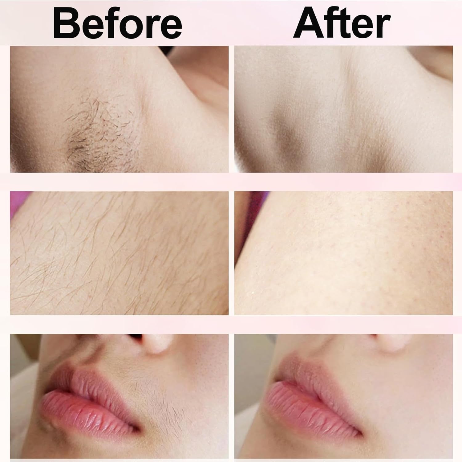 Electric Shaver for Women, 2-In-1 Electric Razor for Womens Legs Underarm Face P
